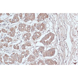 Microtubule-Associated Proteins 1A/1B Light Chain 3B (MAP1LC3B) Antibody