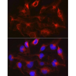 Methyltransferase Like Protein 7B (METTL7B) Antibody