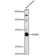 WB analysis of Rat kidney tissue lysate (25 µg), using Methyltransferase HEMK2 (HEMK2) antibody (1/1000 dilution) followed by <a href="https://www.abbexa.com/index.php?route=product/search&search=abx005548" target="_blank">abx005548</a> - HRP-conjugated Goat anti-Rabbit IgG H&L antibody (1/10000 dilution).