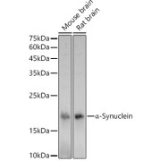 Western blot analysis of various lysates using α-Synuclein Antibody at 1/600 dilution. Secondary antibody: HRP-conjugated Goat anti-Rabbit IgG (H+L) at 1/10000 dilution. Lysates/proteins: 25 µg per lane. Blocking buffer: 3% nonfat dry milk in TBST. Exposure time: 30s.