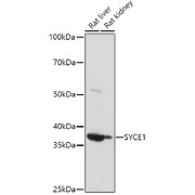 Western blot analysis of various lysates using at 1/1000 dilution. Secondary antibody: HRP-conjugated Goat anti-Rabbit IgG (H+L) at 1/10000 dilution. Lysates/proteins: 25 µg per lane. Blocking buffer: 3% nonfat dry milk in TBST. Exposure time: 30s.