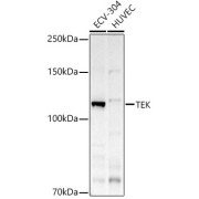 Western blot analysis of various lysates using TEK Antibody at 1/500 dilution. Secondary antibody: HRP-conjugated Goat anti-Rabbit IgG (H+L) at 1/10000 dilution. Lysates/proteins: 25 µg per lane. Blocking buffer: 3% nonfat dry milk in TBST. Exposure time: 30s.