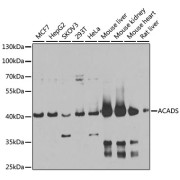 abx005457