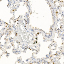 Interleukin 21 (IL21) Antibody