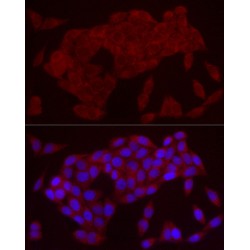 Interleukin 21 (IL21) Antibody