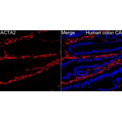 Actin Alpha 2, Smooth Muscle (ACTA2) Antibody