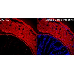 Actin Alpha 2, Smooth Muscle (ACTA2) Antibody