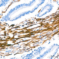 Actin Alpha 2, Smooth Muscle (ACTA2) Antibody