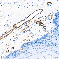 Actin Alpha 2, Smooth Muscle (ACTA2) Antibody