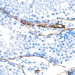 Actin Alpha 2, Smooth Muscle (ACTA2) Antibody
