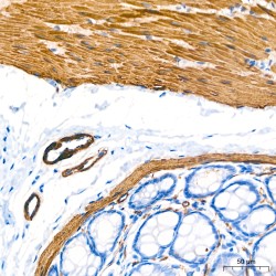 Actin Alpha 2, Smooth Muscle (ACTA2) Antibody