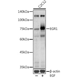 Early Growth Response 1 (EGR1) Antibody