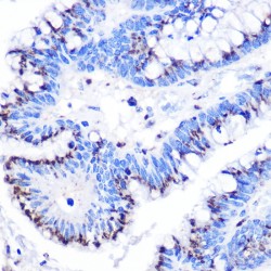 Golgi Membrane Protein 1 (GOLM1) Antibody