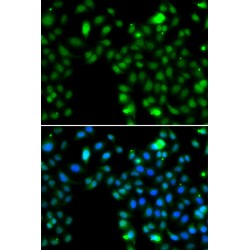 Inhibitor of Growth Protein 5 (ING5) Antibody