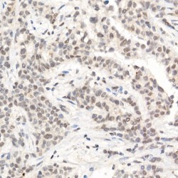 Lethal(3)malignant Brain Tumor-Like Protein 3 (L3MBTL3) Antibody