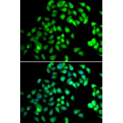 Nuclear Cap Binding Protein Subunit 2 (NCBP2) Antibody