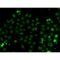 Nerve Growth Factor Receptor-Associated Protein 1 (NGFRAP1) Antibody