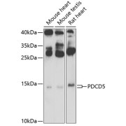 Western blot analysis of various lysates using PDCD5 Antibody at 1/500 dilution. Secondary antibody: HRP-conjugated Goat anti-Rabbit IgG (H+L) at 1/10000 dilution. Lysates/proteins: 25 µg per lane. Blocking buffer: 3% nonfat dry milk in TBST. Exposure time: 10s.
