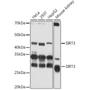 Immunohistochemistry analysis of paraffin-embedded Human colon carcinoma using SIRT3 Antibody at dilution of 1/50 (40x lens). High pressure antigen retrieval performed in 0.01 M Citrate buffer (pH 6.0) prior to IHC staining.