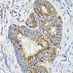 Sirtuin 3 (SIRT3) Antibody