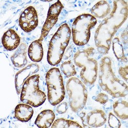 Sirtuin 3 (SIRT3) Antibody
