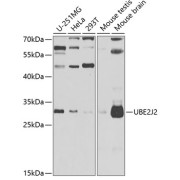 Western blot analysis of various lysates using UBE2J2 Antibody at 1/1000 dilution. Secondary antibody: HRP-conjugated Goat anti-Rabbit IgG (H+L) at 1/10000 dilution. Lysates/proteins: 25 µg per lane. Blocking buffer: 3% nonfat dry milk in TBST. Exposure time: 90s.