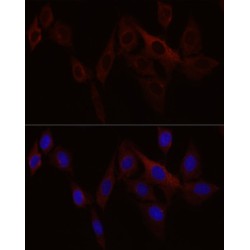 Stromal Interaction Molecule 1 (STIM1) Antibody
