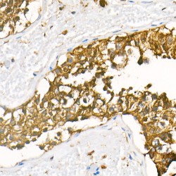 Goat Anti-Rabbit IgG H&L Antibody (HRP)