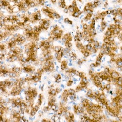 Donkey Anti-Rabbit IgG H&L Antibody (HRP)