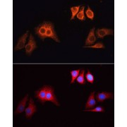 Immunofluorescence analysis of HeLa cells, using Rhodamine (TRITC) Goat Anti-Rabbit IgG (H+L) as the primary antibody at dilution of 1/100. The cells were incubated with the primary antibody overnight at 4°C. Secondary antibody: Rhodamine (TRITC) Goat Anti-Rabbit IgG (H+L) at 1/200 dilution. Blue: DAPI for nuclear staining.
