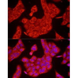 Glyceraldehyde-3-Phosphate Dehydrogenase (GAPDH) Antibody