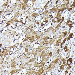 Glyceraldehyde-3-Phosphate Dehydrogenase (GAPDH) Antibody