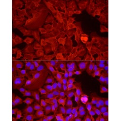 Glyceraldehyde-3-Phosphate Dehydrogenase (GAPDH) Antibody