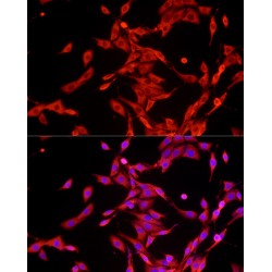Glyceraldehyde-3-Phosphate Dehydrogenase (GAPDH) Antibody