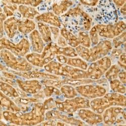Glyceraldehyde-3-Phosphate Dehydrogenase (GAPDH) Antibody