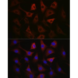 Glyceraldehyde-3-Phosphate Dehydrogenase (GAPDH) Antibody