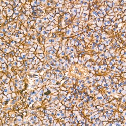 Actin, Cytoplasmic 1 (ACTB) Antibody