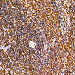 Actin, Cytoplasmic 1 (ACTB) Antibody