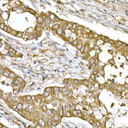 Tubulin Beta (TUBB) Antibody
