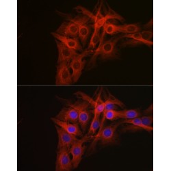 Tubulin Beta (TUBB) Antibody