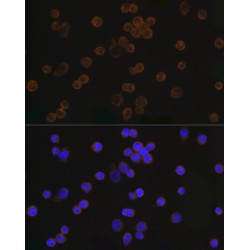 DDDDK-Tag Antibody