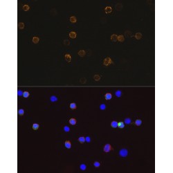 DDDDK-Tag Antibody