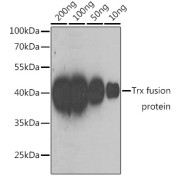 Western blot analysis of over-expressed Trx fusion protein using Mouse anti Trx-Tag antibody at 1/5000 dilution. Secondary antibody: HRP-conjugated Goat anti-Mouse IgG (H+L) at 1/10000 dilution. Blocking buffer: 3% nonfat dry milk in TBST.