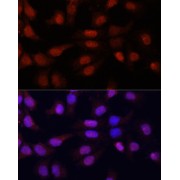 Immunofluorescence analysis of HeLa cells using N5-Methylcytidine Antibody at dilution of 1/100. Secondary antibody: Cy3-conjugated Goat anti-Rabbit IgG (H+L) at 1/500 dilution. Blue: DAPI for nuclear staining.
