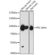 Western blot analysis of various lysates using PKC delta Antibody at 1/1000 dilution. Secondary antibody: HRP-conjugated Goat anti-Rabbit IgG (H+L) at 1/10000 dilution. Lysates/proteins: 25 µg per lane. Blocking buffer: 3% nonfat dry milk in TBST. Exposure time: 1min.