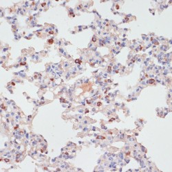 Protein Kinase C Delta (PRKCD) Antibody