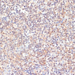 Protein Kinase C Delta (PRKCD) Antibody