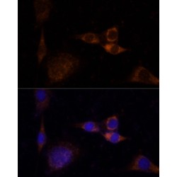 Protein Kinase C Delta (PRKCD) Antibody