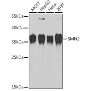 Western blot analysis of various lysates using SMN2 Antibody at 1/1000 dilution. Secondary antibody: HRP-conjugated Goat anti-Rabbit IgG (H+L) at 1/10000 dilution. Lysates/proteins: 25 µg per lane. Blocking buffer: 3% nonfat dry milk in TBST. Exposure time: 30s.