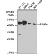 Western blot analysis of various lysates using RPH3AL Antibody at 1/1000 dilution. Secondary antibody: HRP-conjugated Goat anti-Rabbit IgG (H+L) at 1/10000 dilution. Lysates/proteins: 25 µg per lane. Blocking buffer: 3% nonfat dry milk in TBST. Exposure time: 90s.